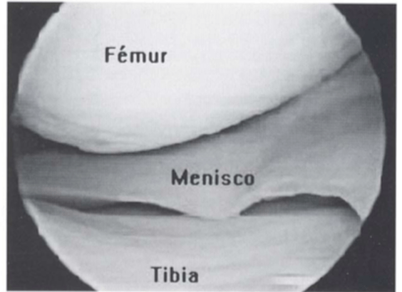 menisco-resport-clinic